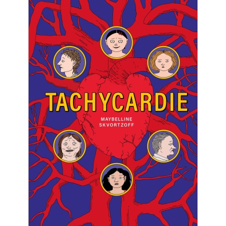 Tachycardie